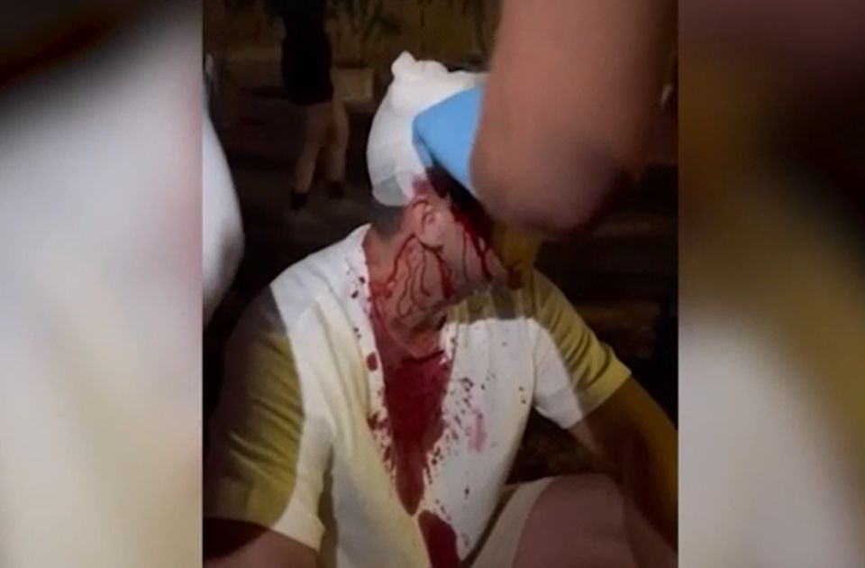 Beverték az ellenzéki képviselő fejét a haladók verőemberei