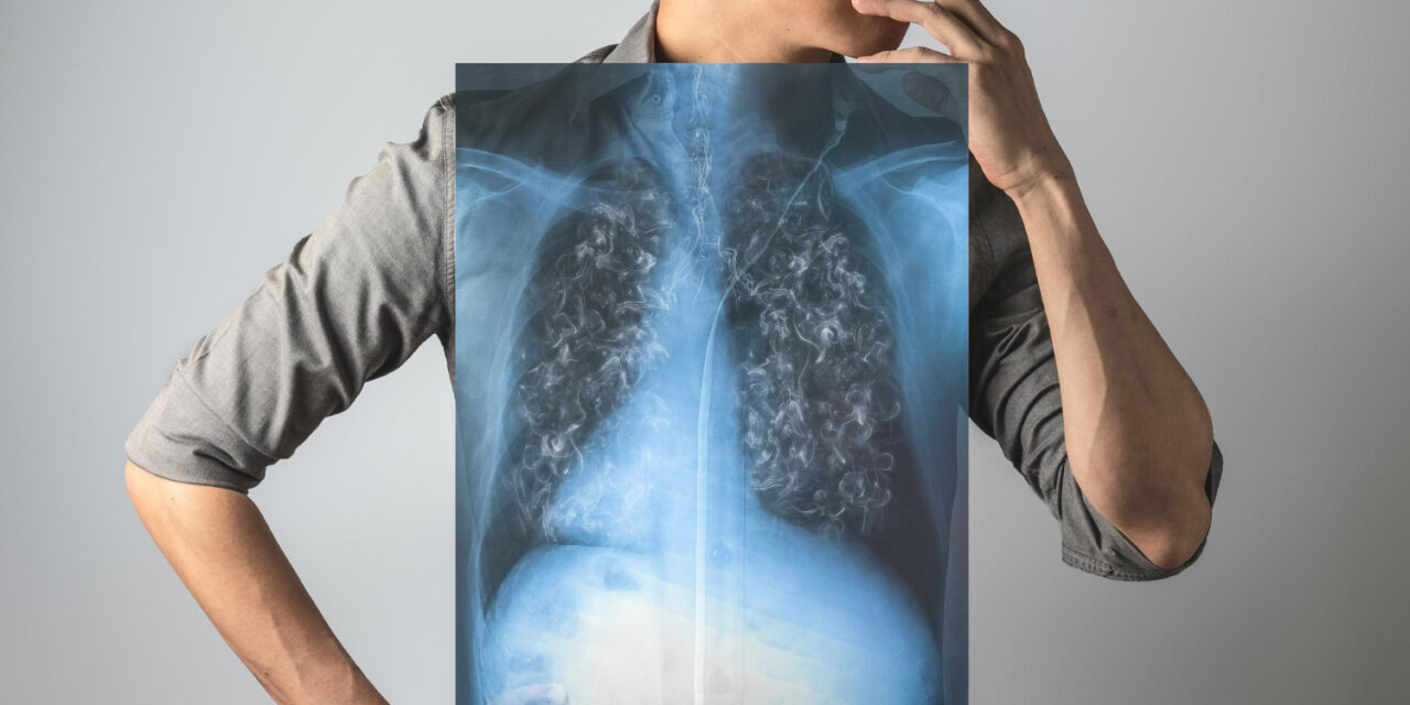 Félmillió ember szenved krónikus tüdőbetegségben, minden harmadik felnőtt dohányzik