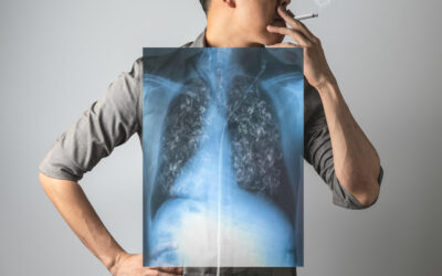 Félmillió ember szenved krónikus tüdőbetegségben, minden harmadik felnőtt dohányzik