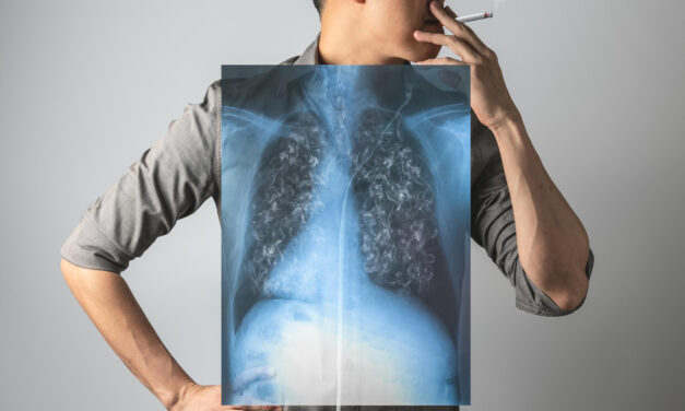 Félmillió ember szenved krónikus tüdőbetegségben, minden harmadik felnőtt dohányzik