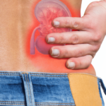 Mikroméretű robotokkal semmisítik meg a vesekövet